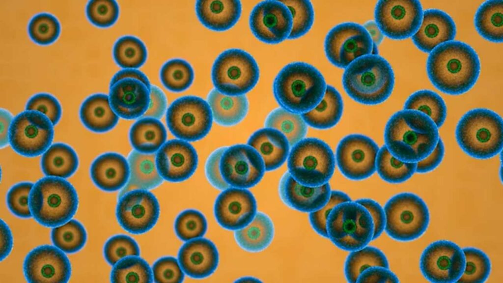 Brain Cancer Battle One Woman's Brain Cap Treatment Story NJ