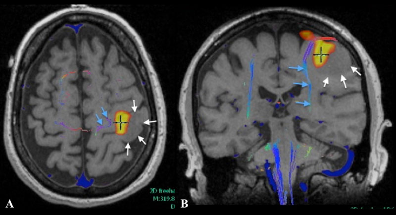 Intraoperative images taken at surgery with normal light