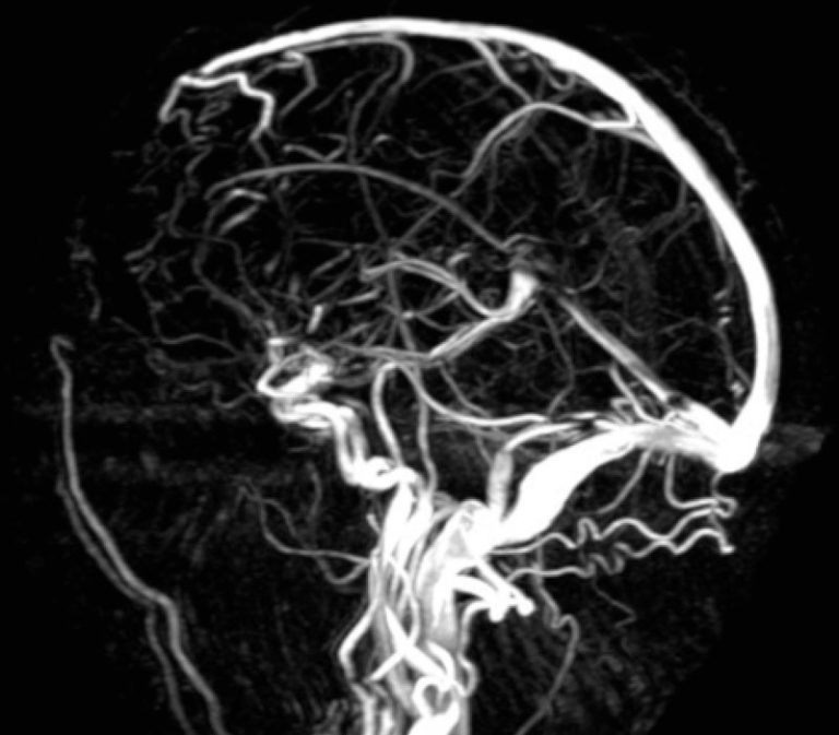 Resonance Imaging (MRI) New Jersey Brain and Spine