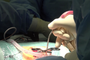 Surgeons performing spinal fusion procedure