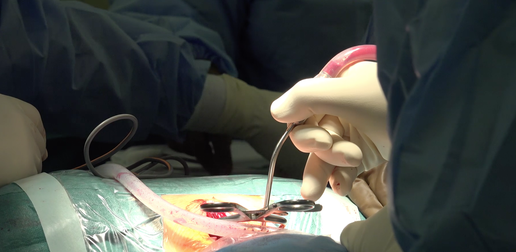 Surgeons performing spinal fusion procedure