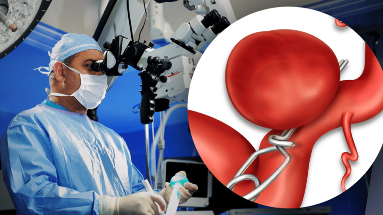 Aneurysm Coiling - Effectively Treating a Ruptured Aneurysm