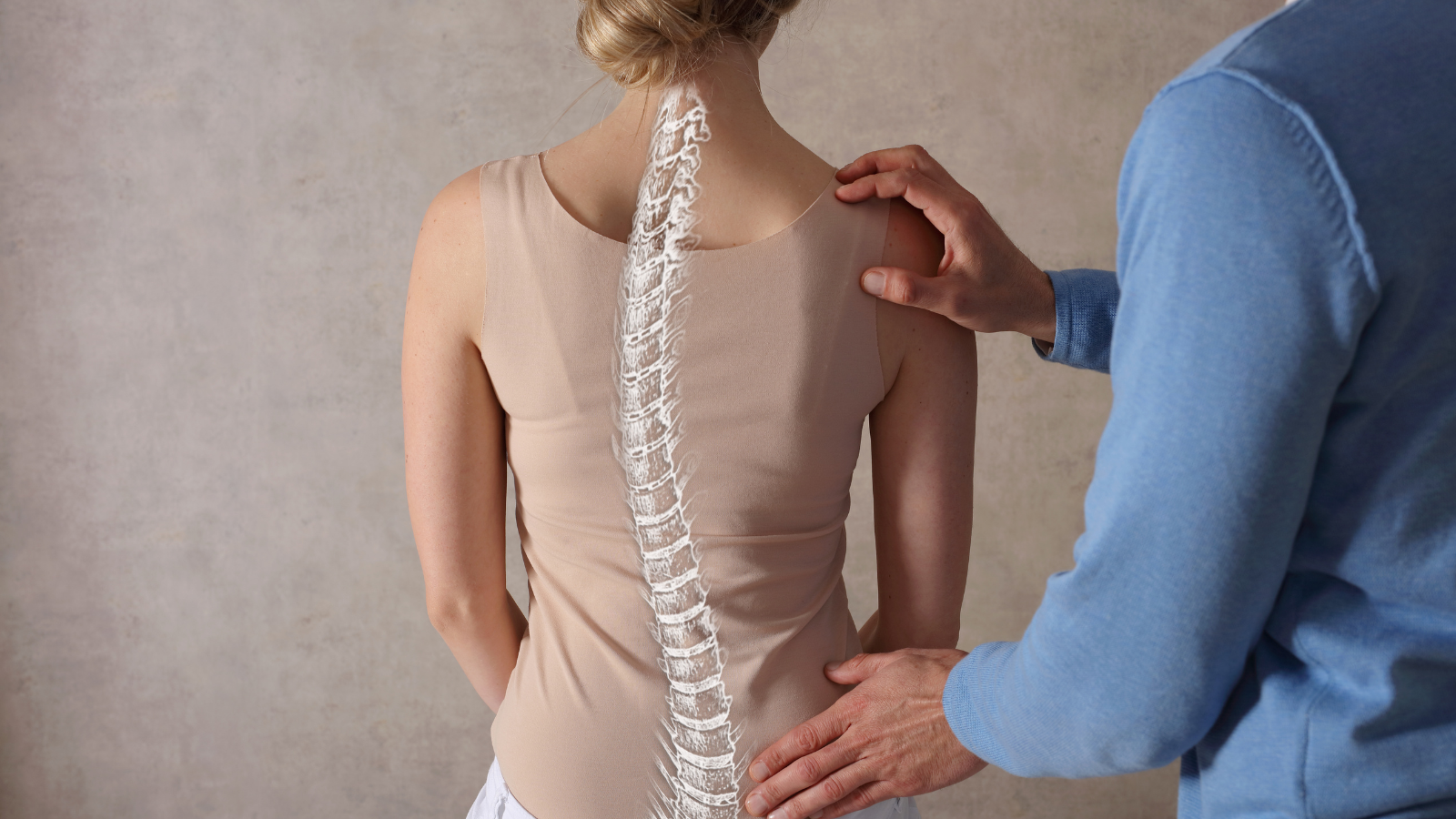 Spinal Fusion for Scoliosis