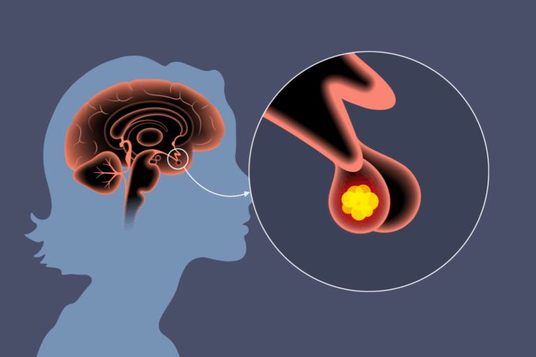 New Jersey Brain and Spine | Understanding Pituitary Tumors - Types of Surgery and What to Expect from Recovery