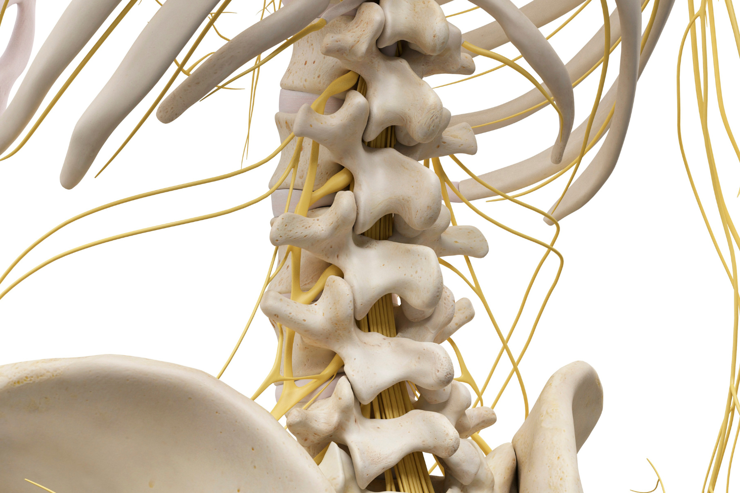 Diagram showing nerve root compression from a herniated disc causing radiculopathy at New Jersey Brain and Spine