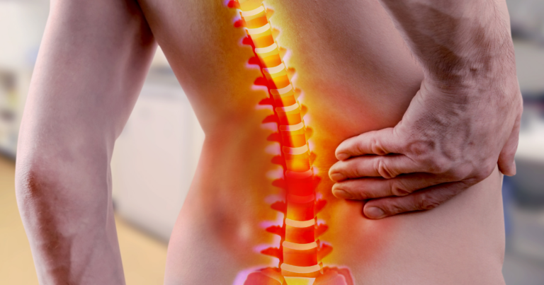Adjacent segment disease after spinal fusion, New Jersey Brain and Spine